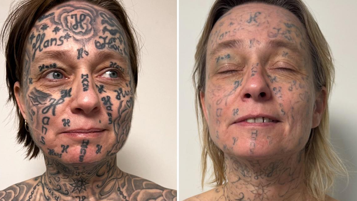 Φρίκη στην Ολλανδία: Άνδρας «σημάδεψε» τη σύντροφό του με 250 τατουάζ